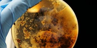 #MUNDO Uso de antibióticos en animales es una amenaza a la salud global